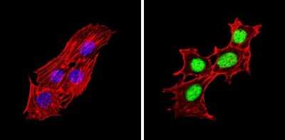 Immunocytochemistry/ Immunofluorescence: PPAR alpha/NR1C1 [p Ser12] Antibody [NB120-3484]